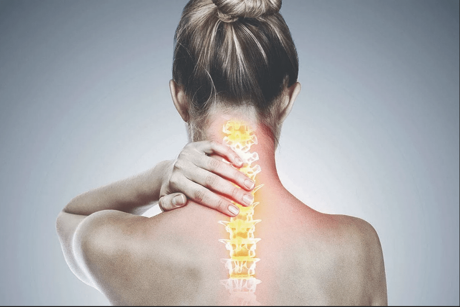 osteocondrosi cervicale